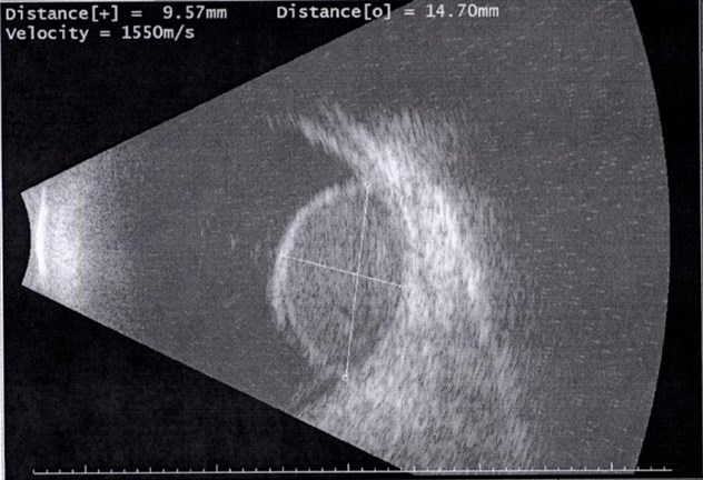 Oral-Exam-Sample-3-ImageC